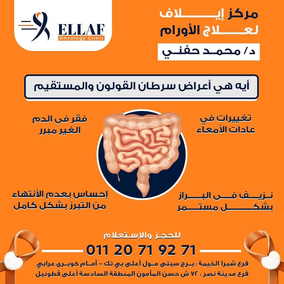 خدمة 2